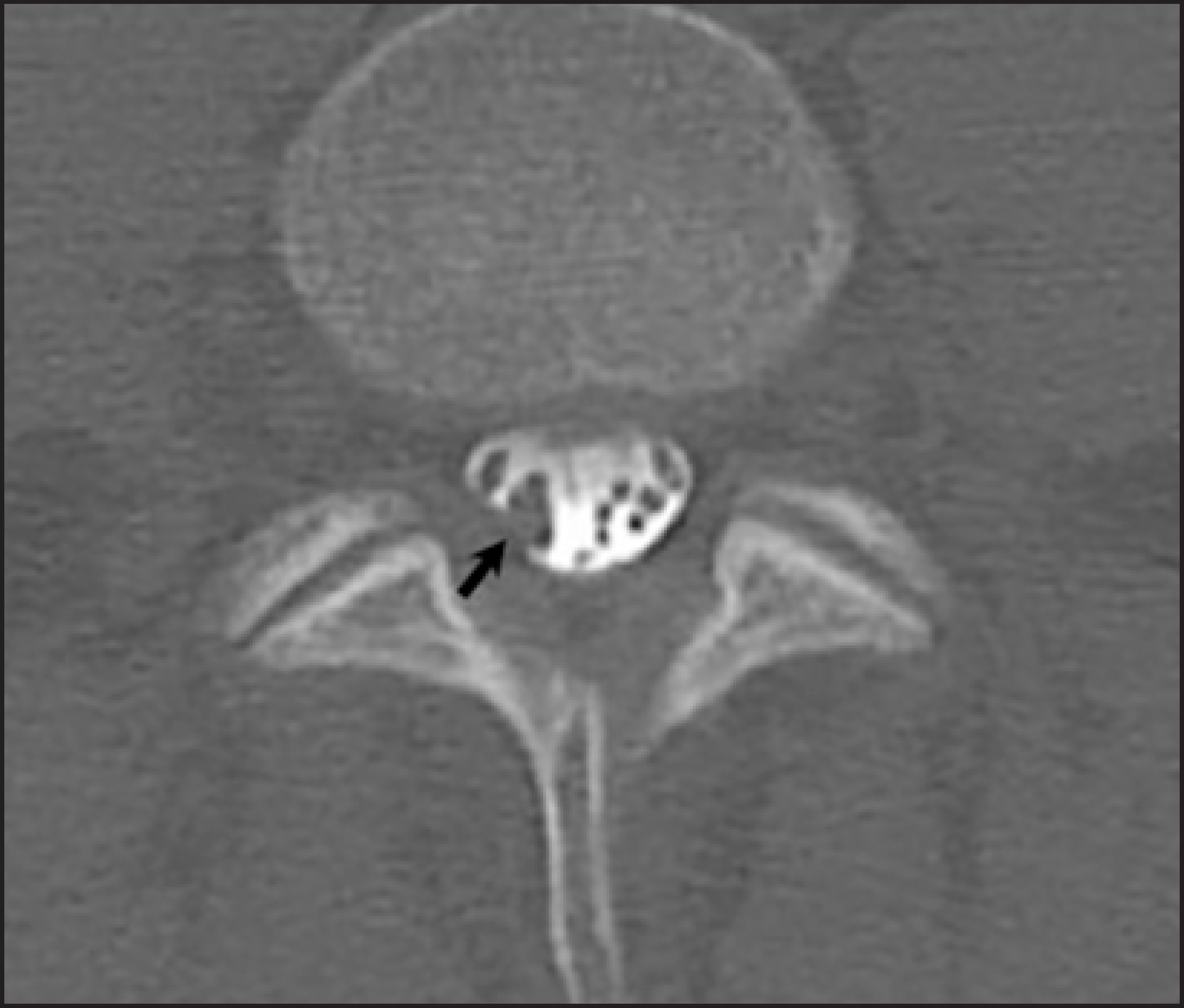 FIGURE 13.