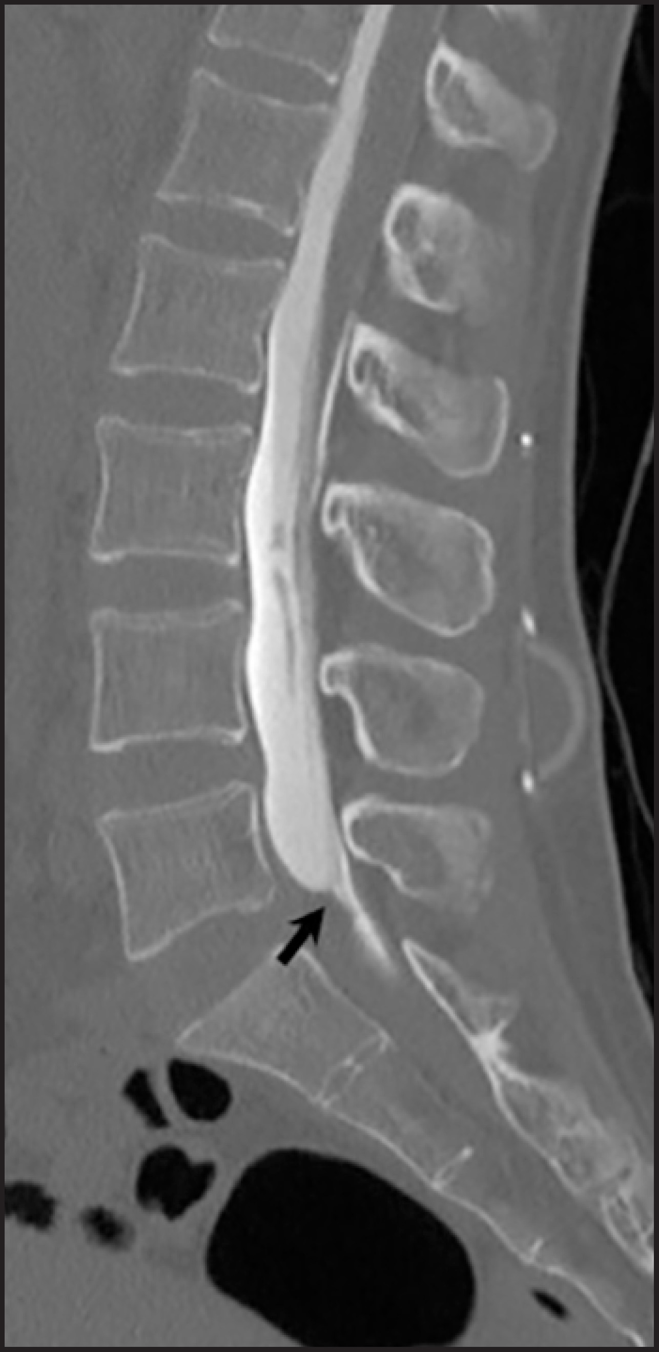 FIGURE 14.