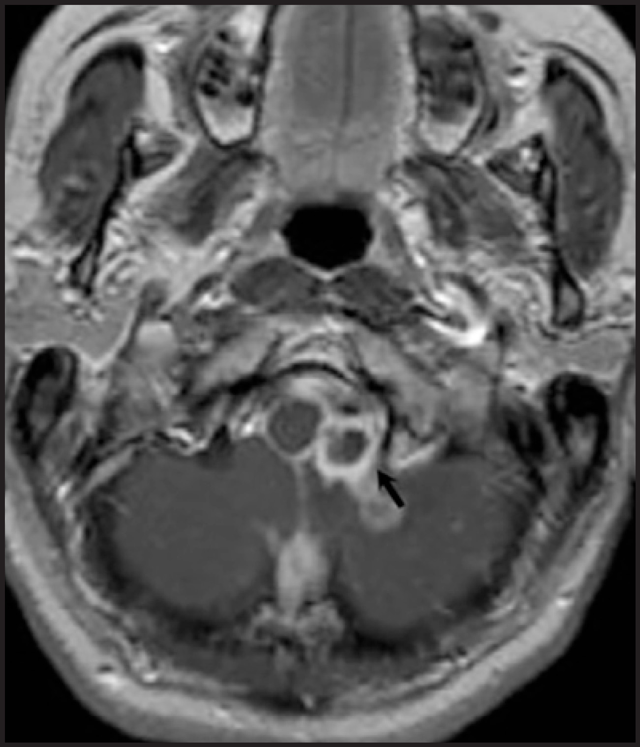 FIGURE 16.