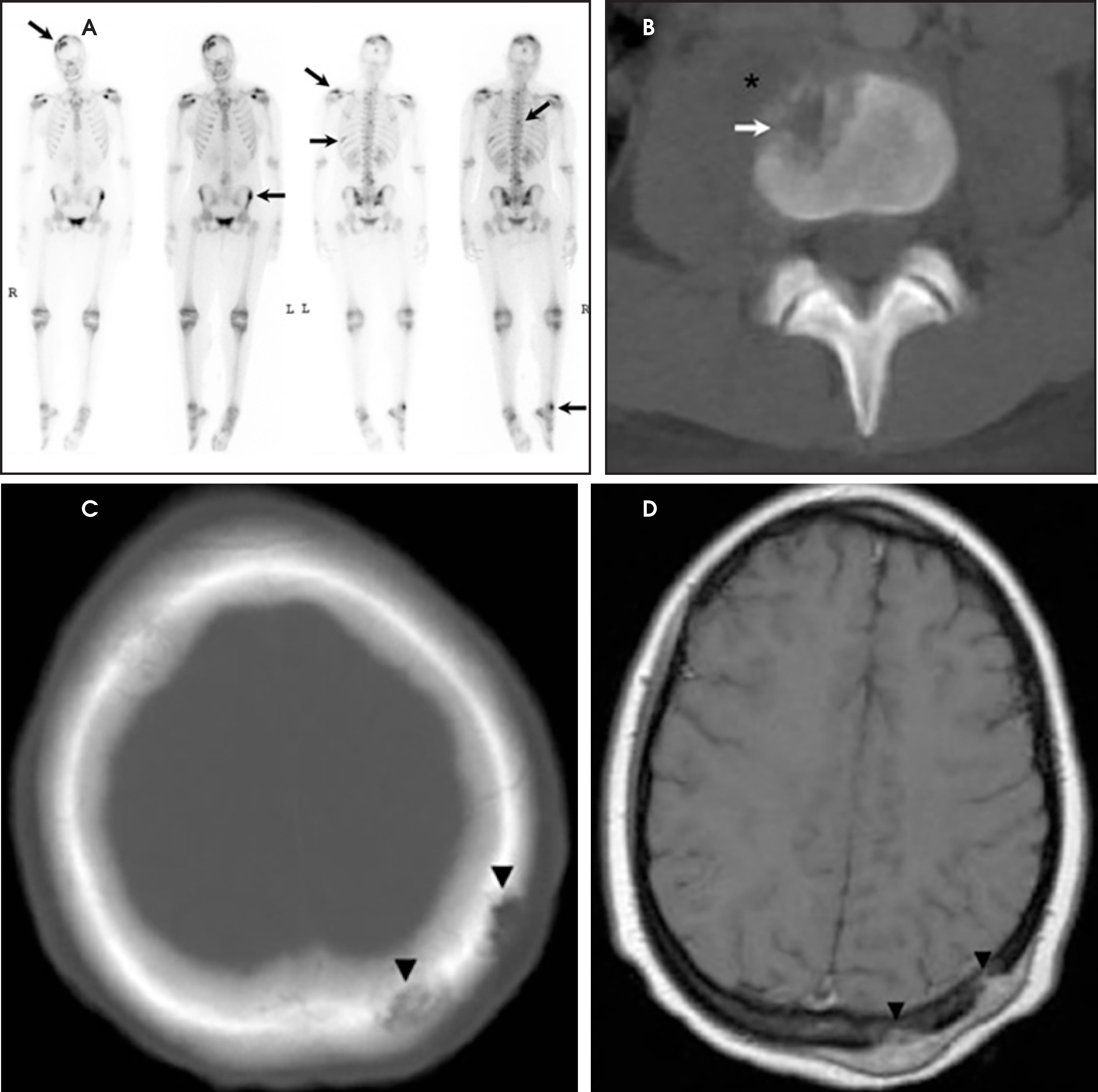 FIGURE 17.