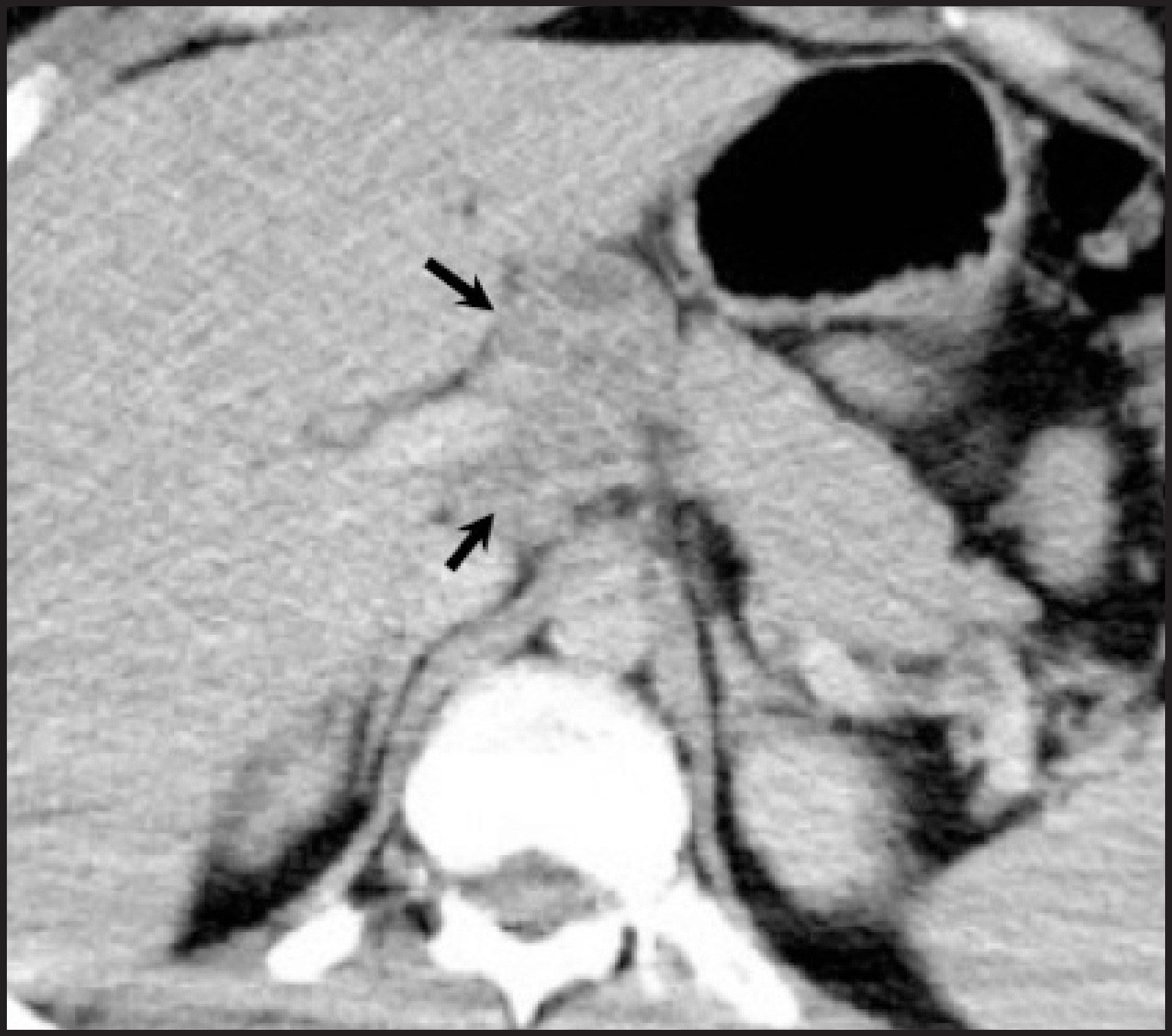 FIGURE 22.