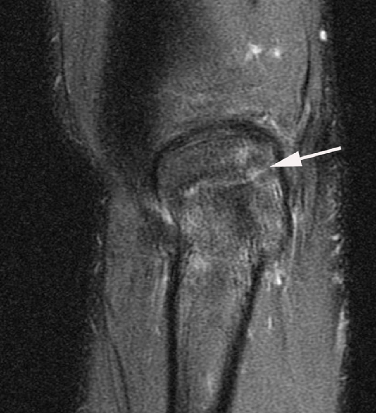 FIGURE 11.