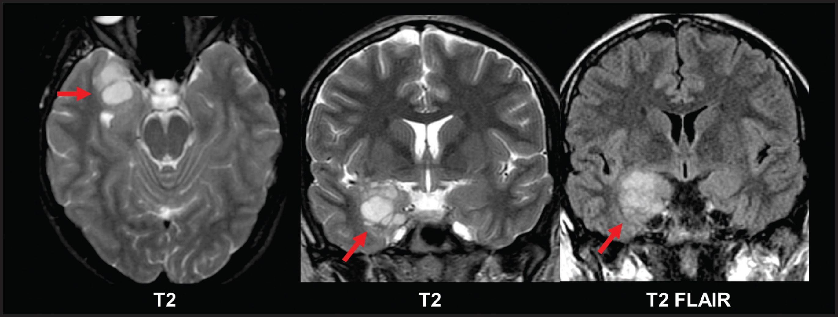 FIGURE 11.