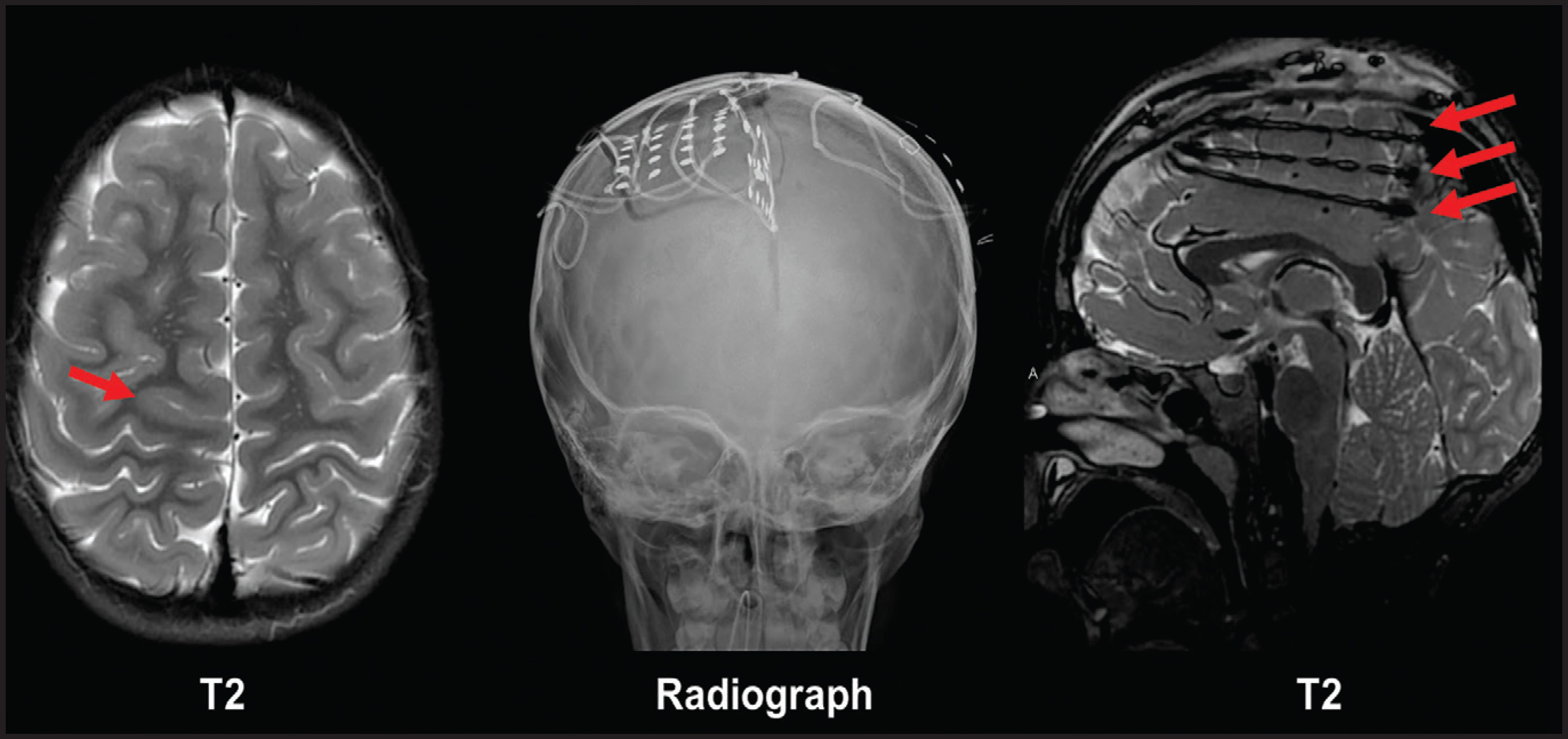 FIGURE 13.