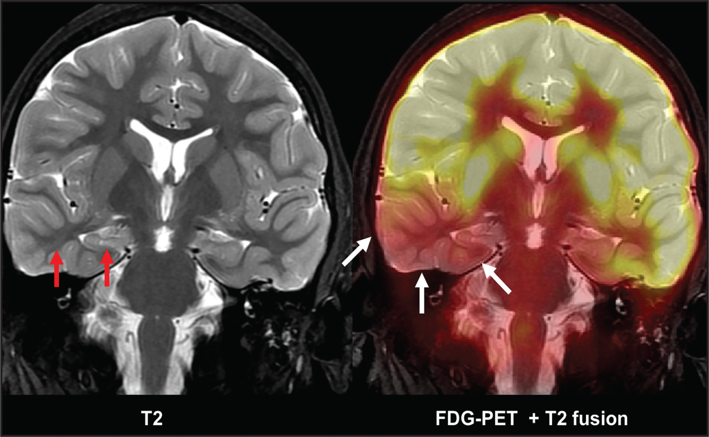 FIGURE 14.