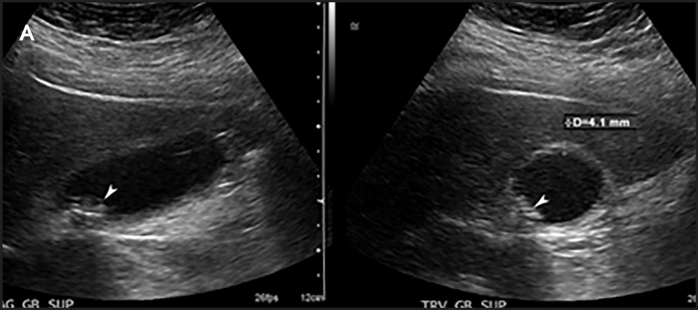 FIGURE 4A