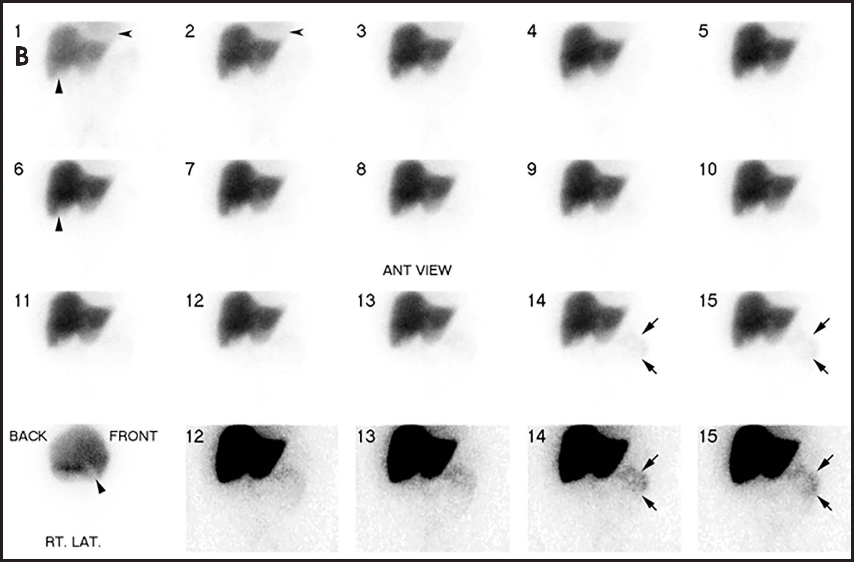 FIGURE 4B