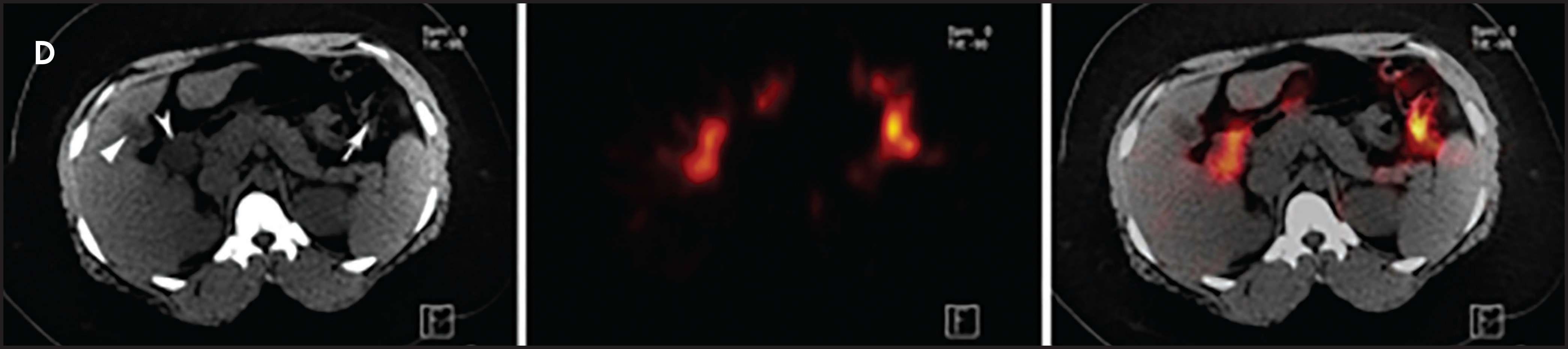 FIGURE 4D