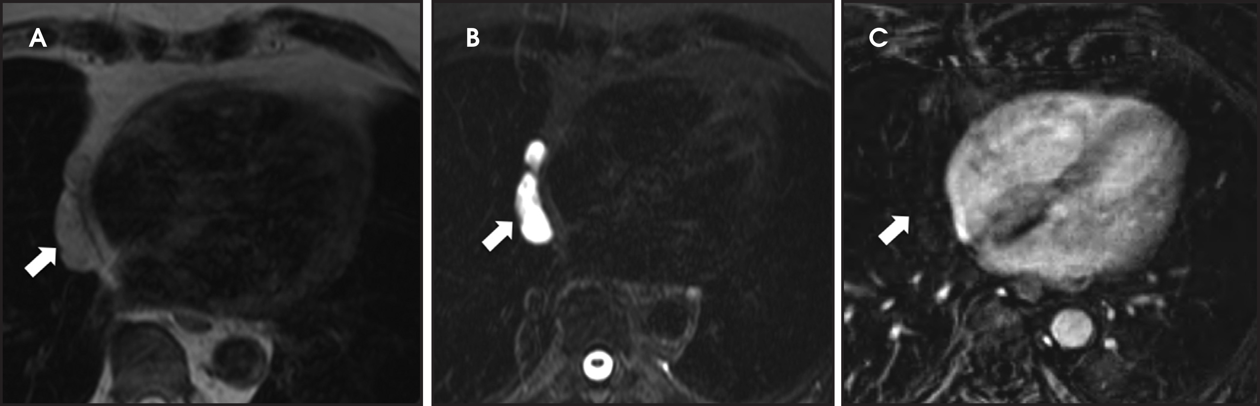 FIGURE 13.