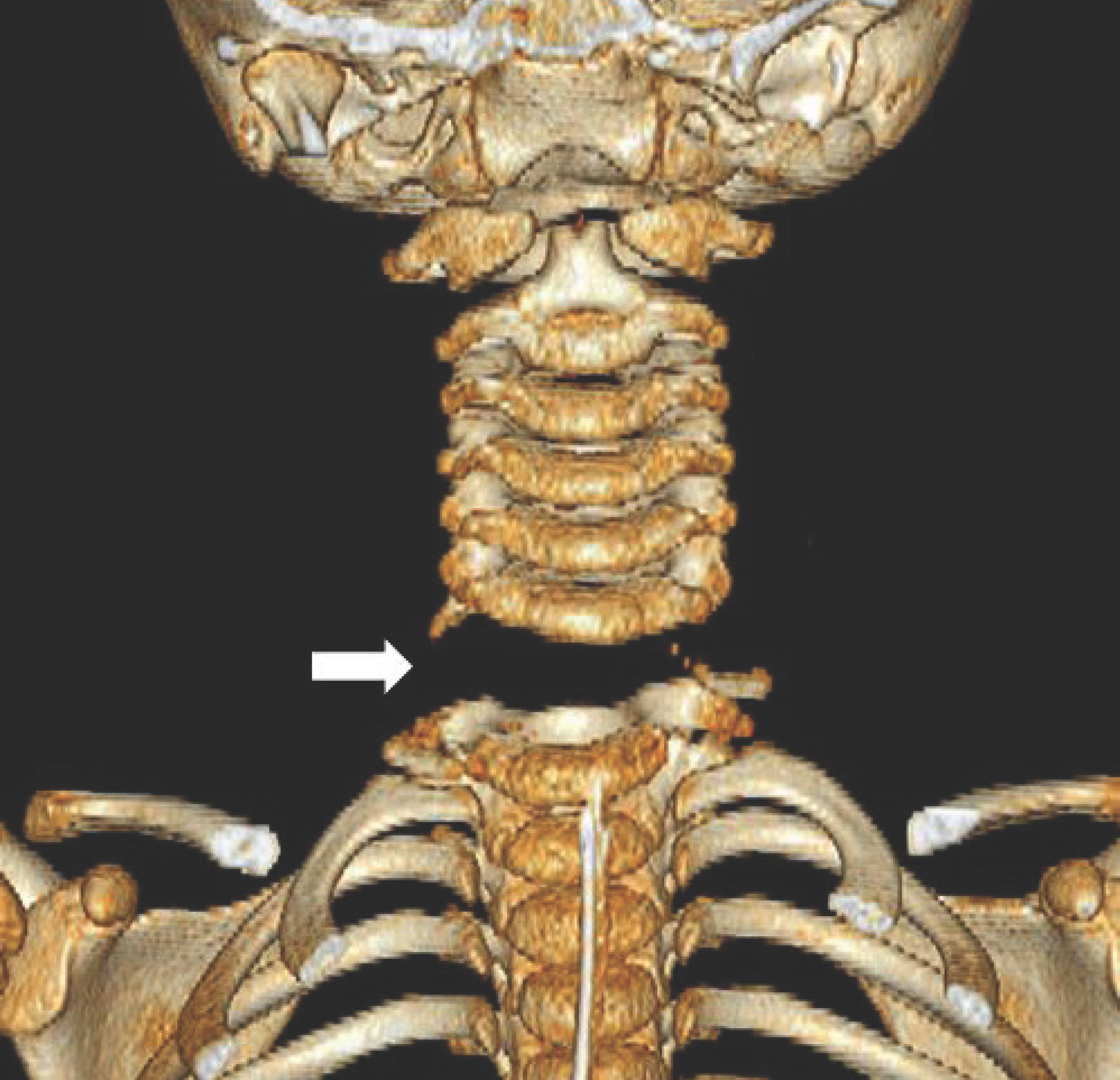 FIGURE 4.