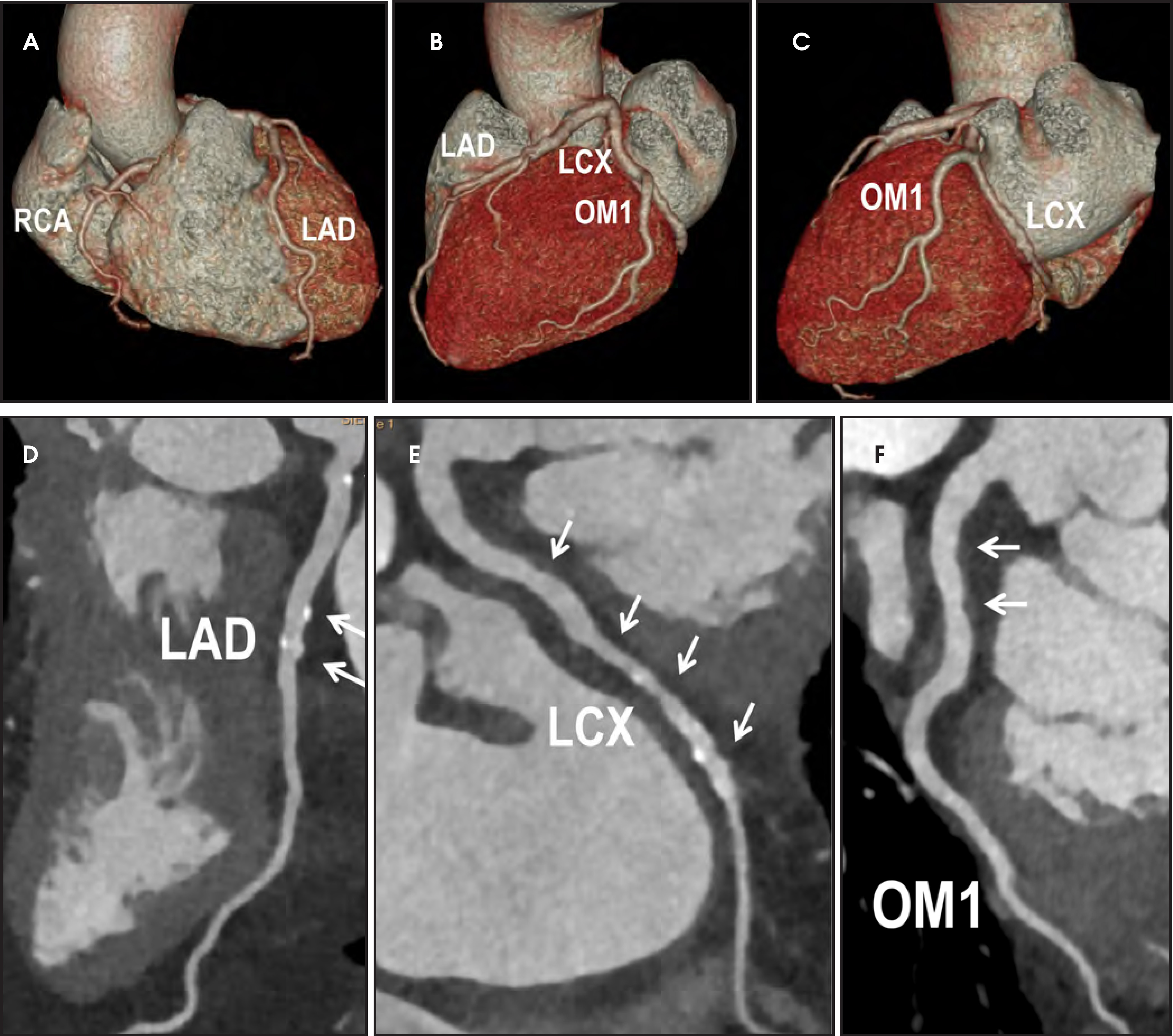 FIGURE 4.