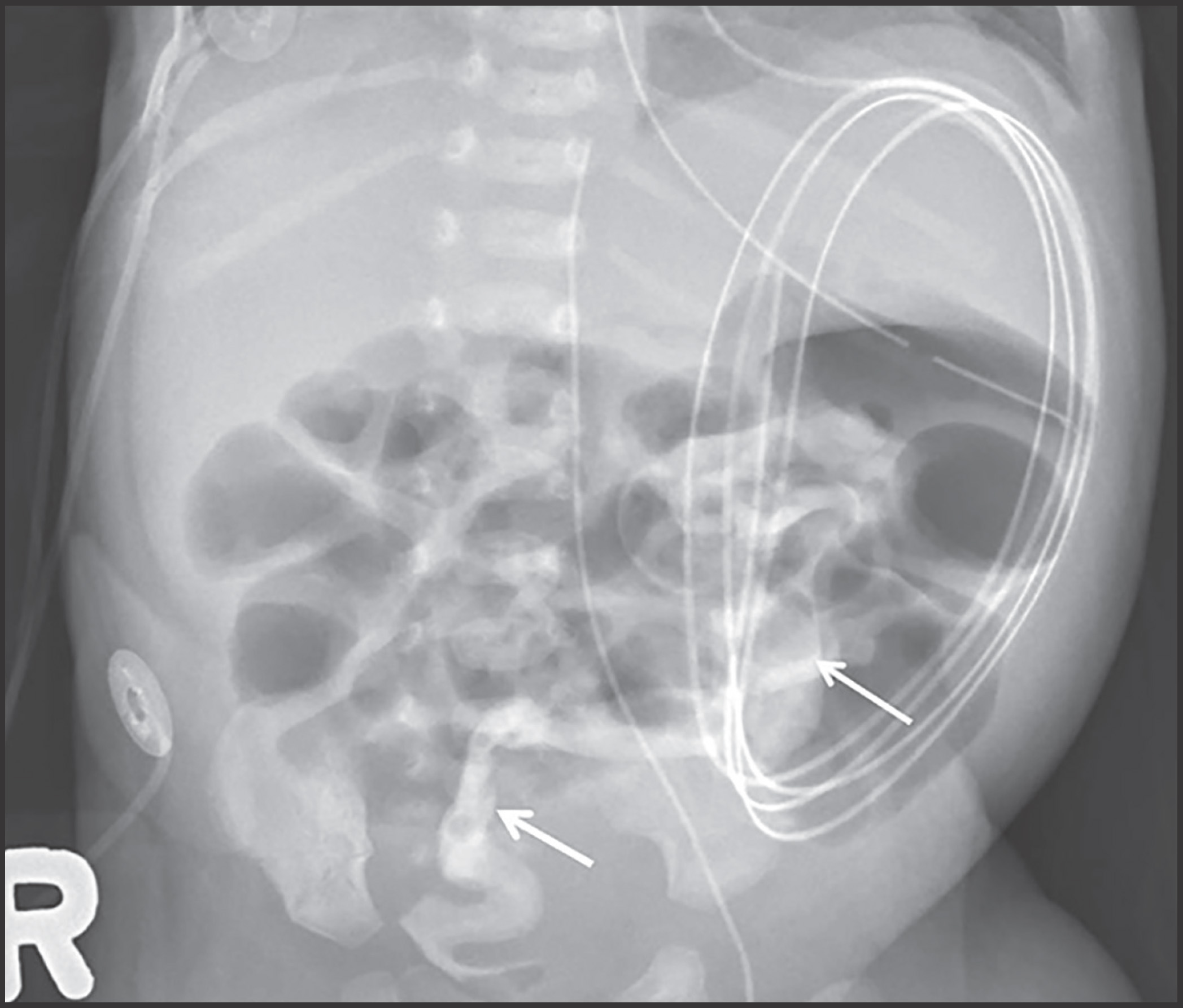 FIGURE 3.