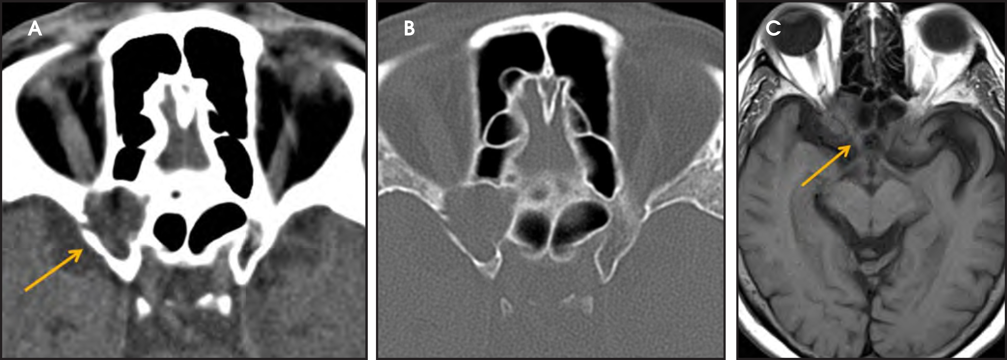 FIGURE 4.