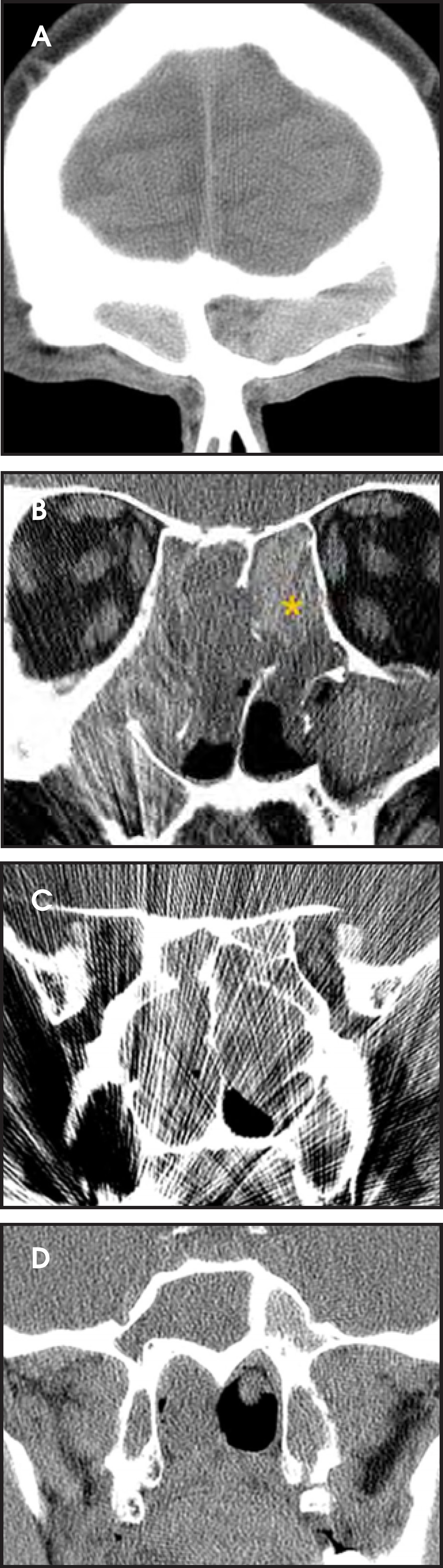 FIGURE 11.