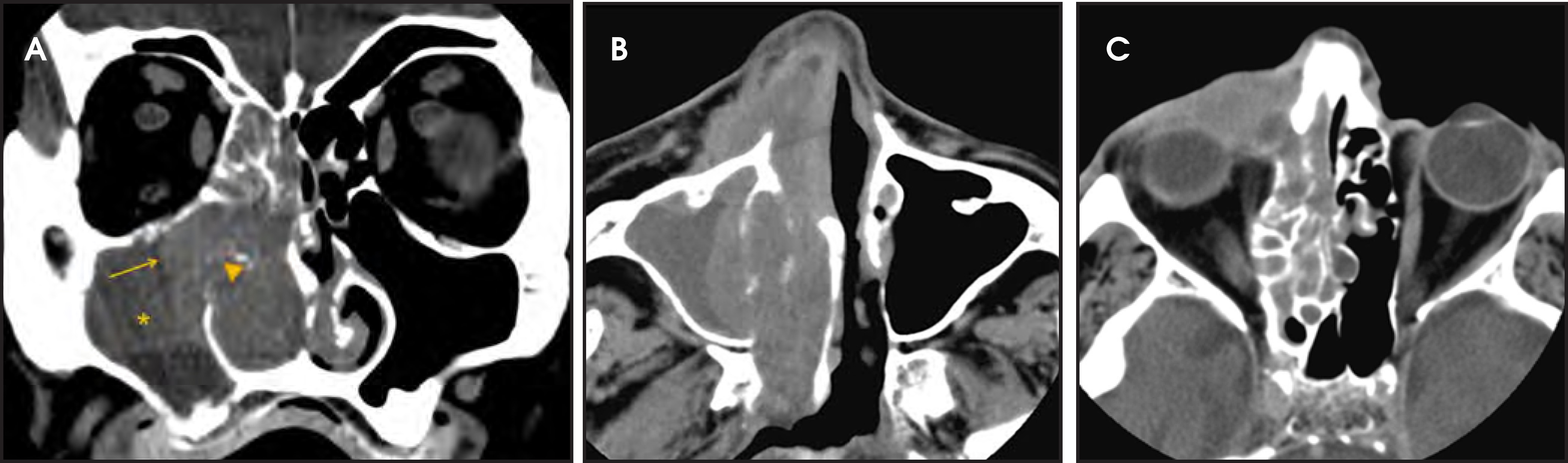 FIGURE 13.