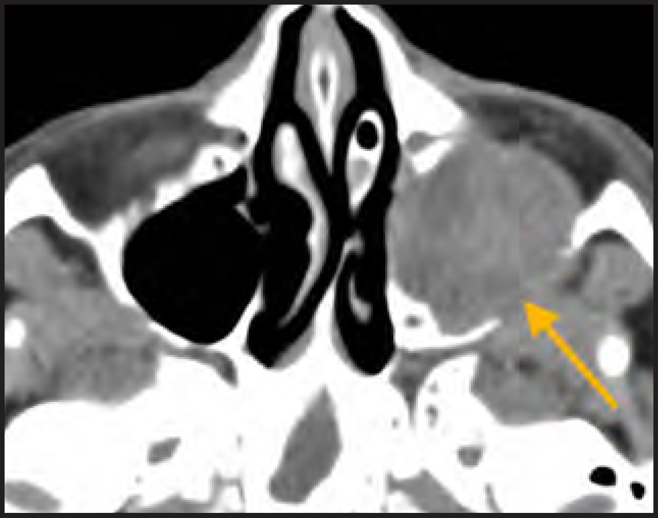 FIGURE 14.