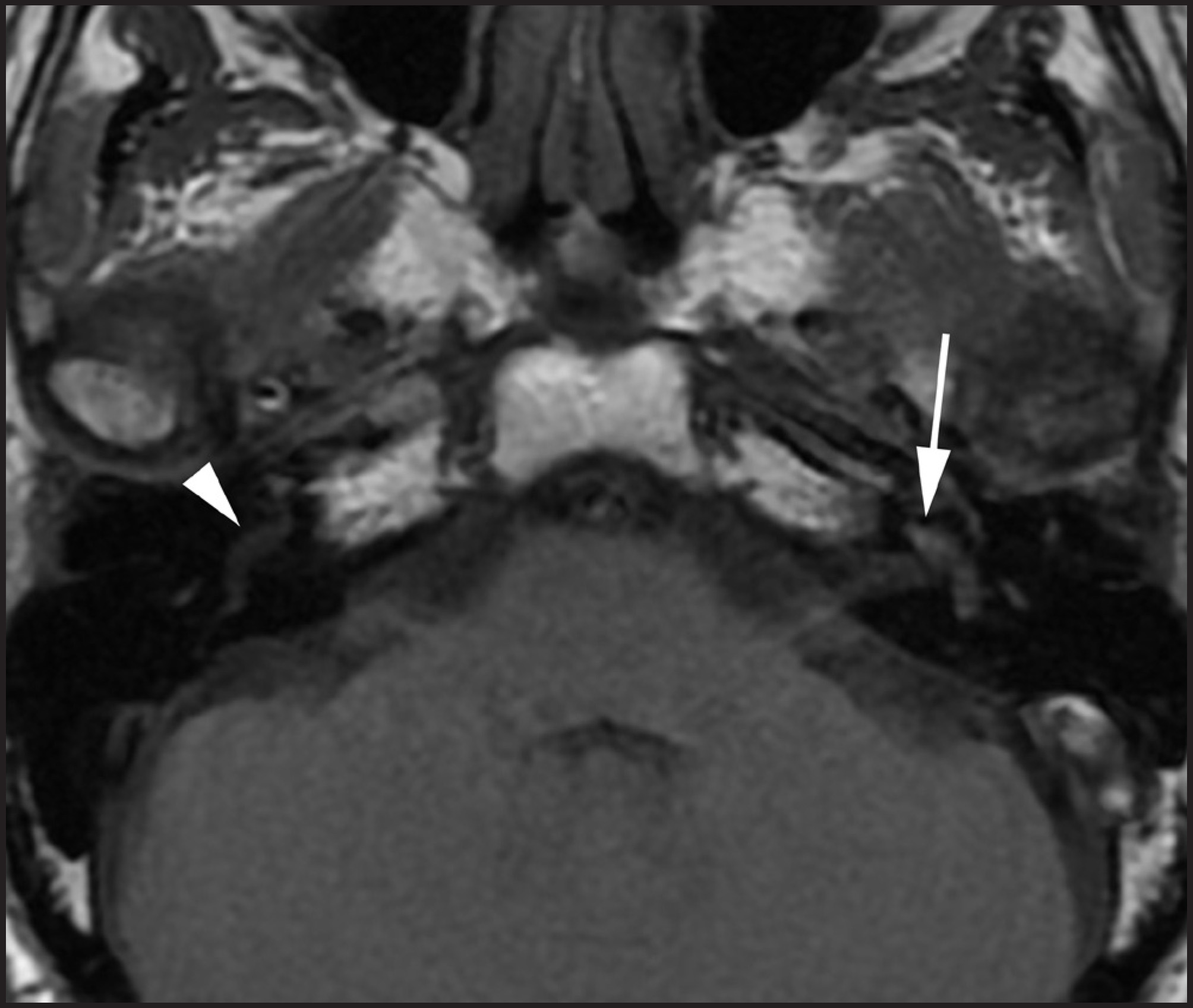 FIGURE 11.