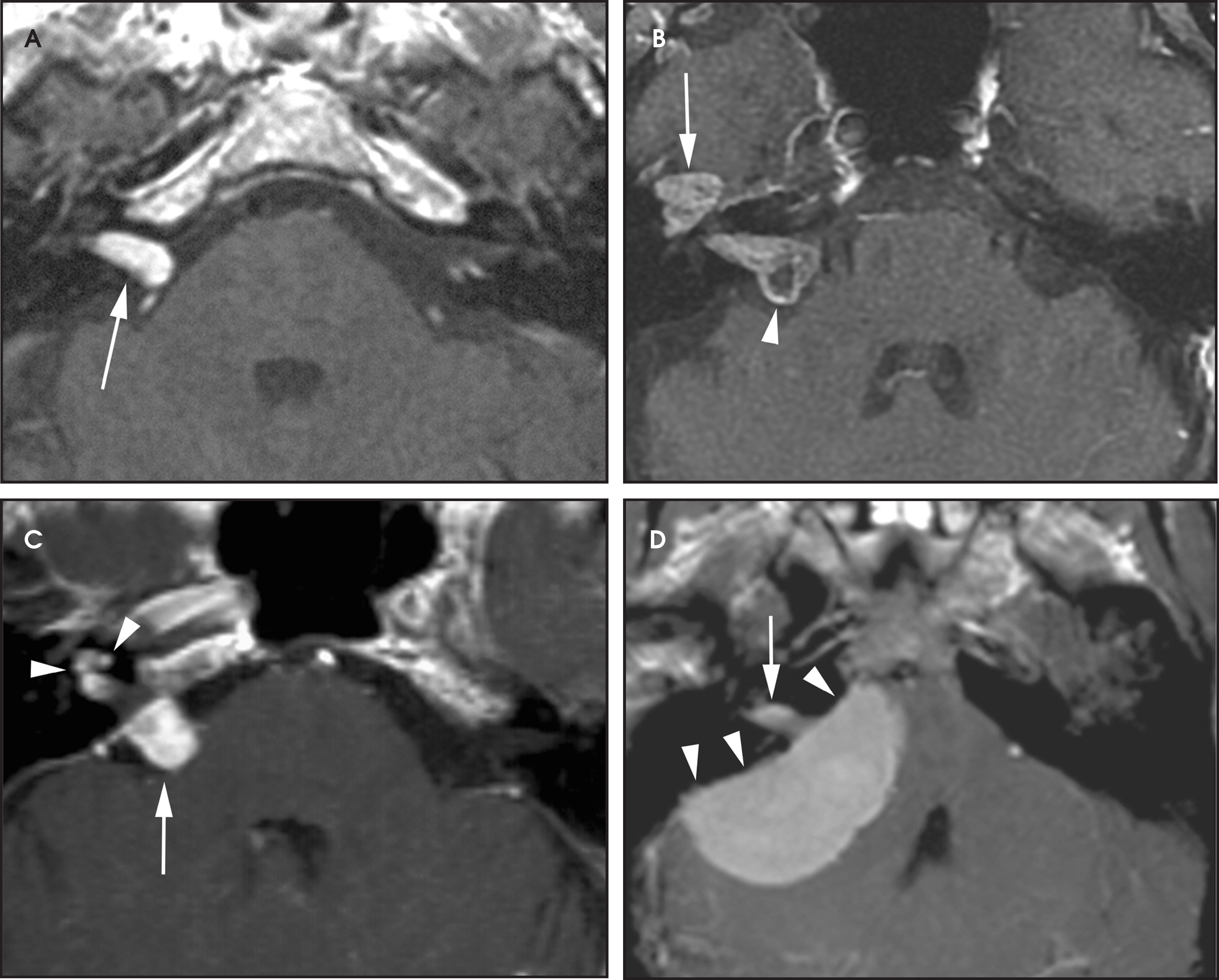 FIGURE 13.