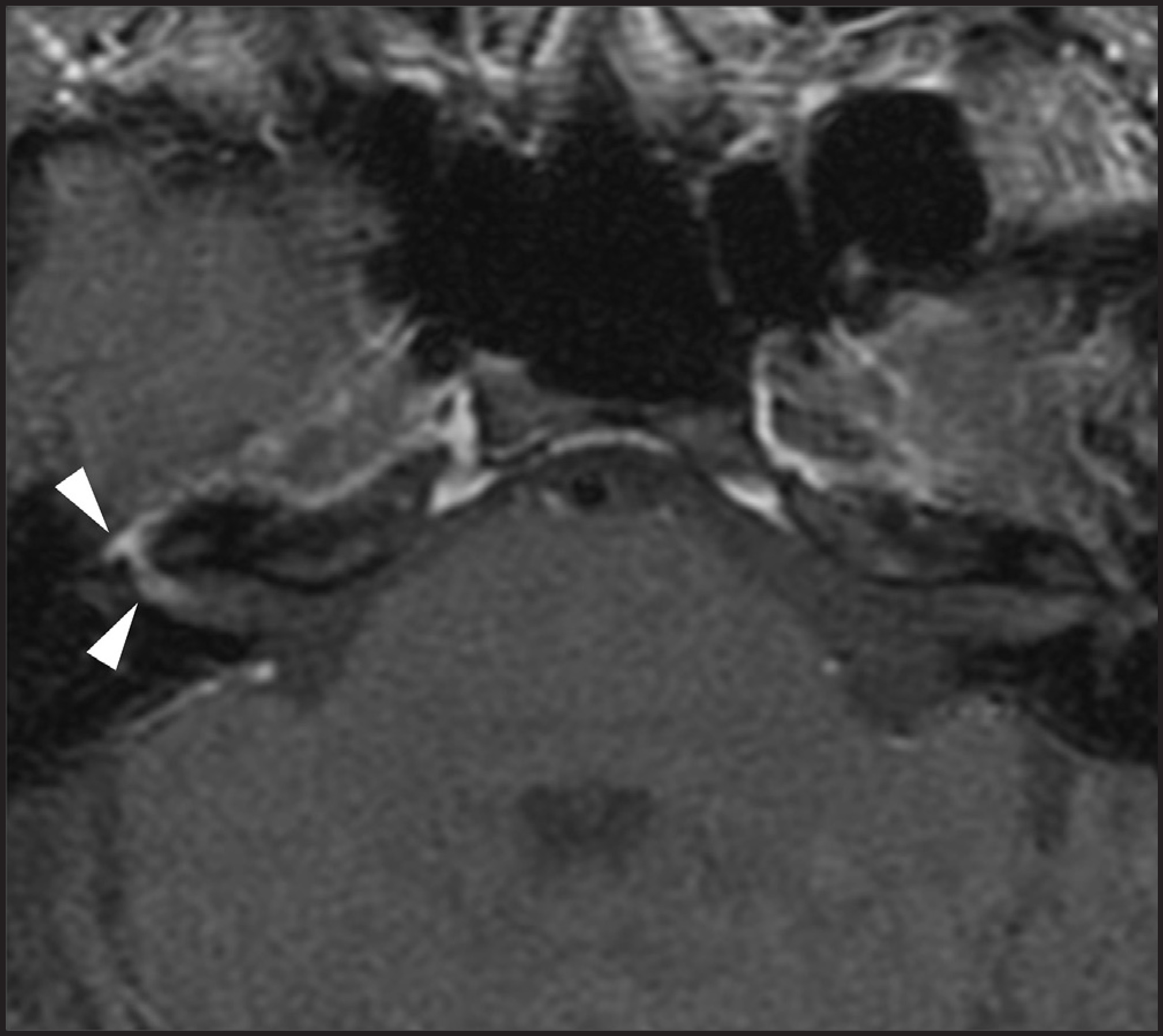 FIGURE 14.