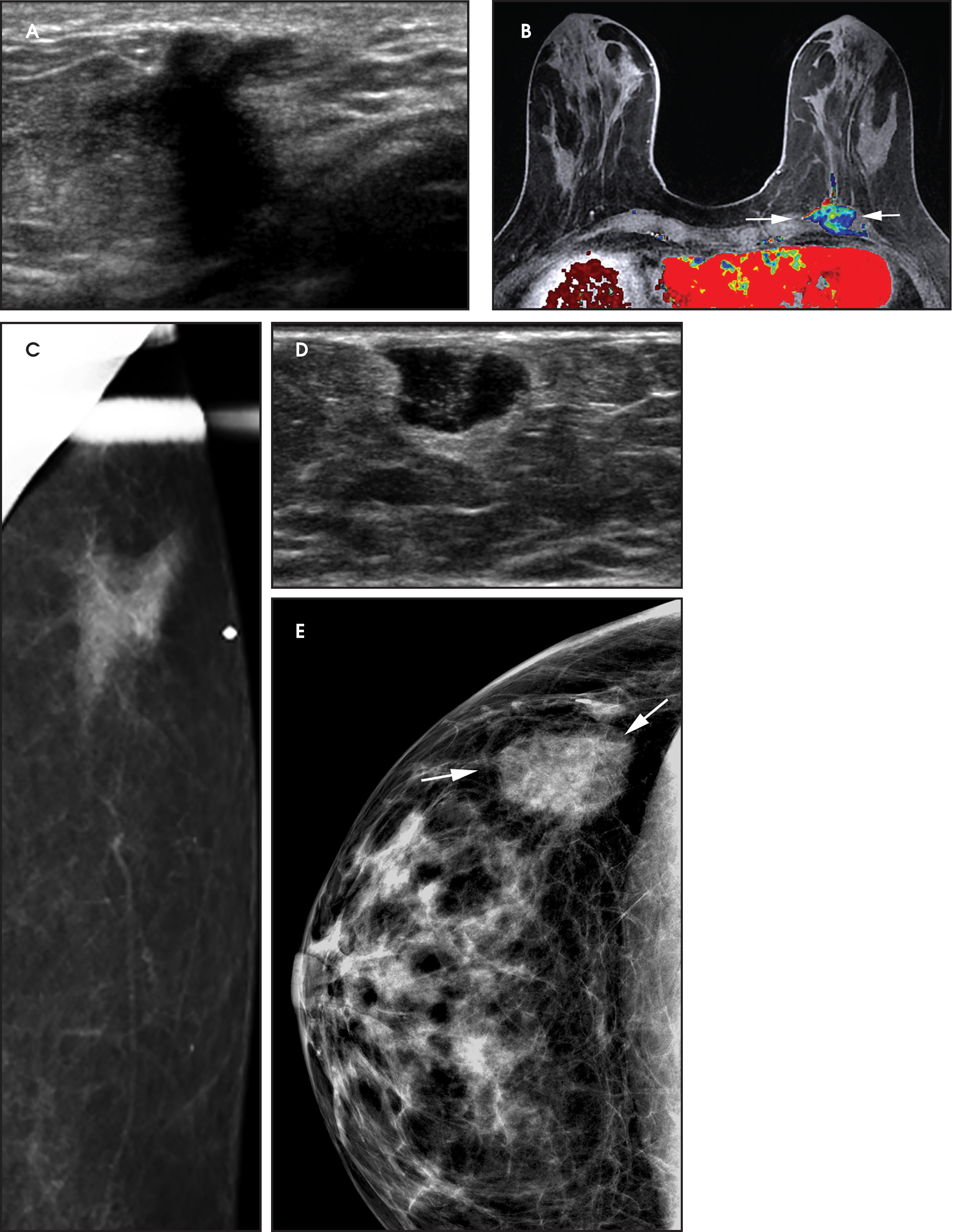 FIGURE 4.