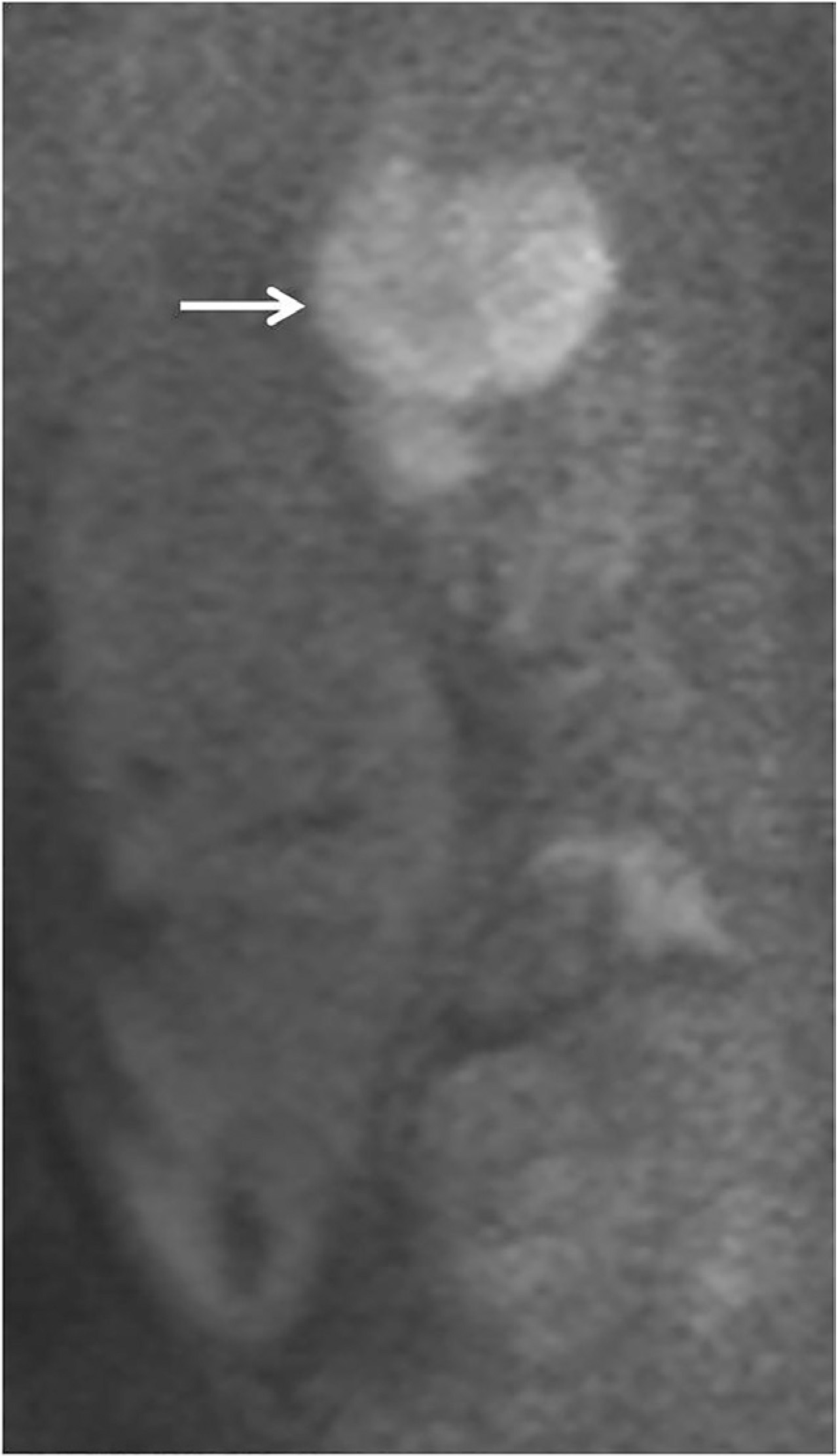 FIGURE 3.
