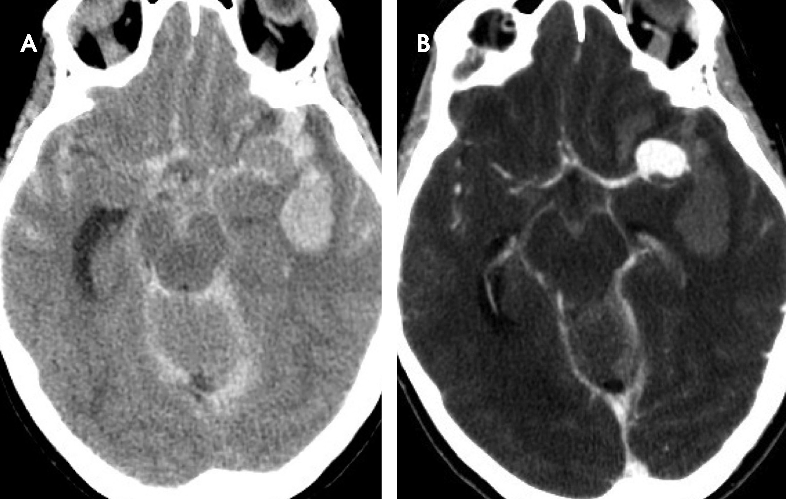 FIGURE 11.