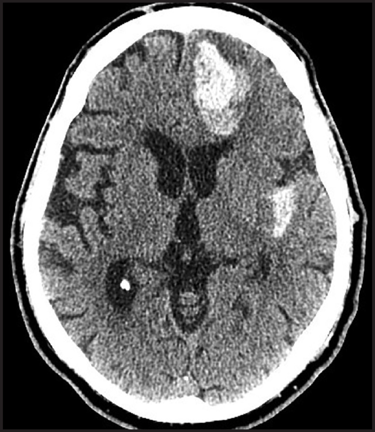 FIGURE 12.