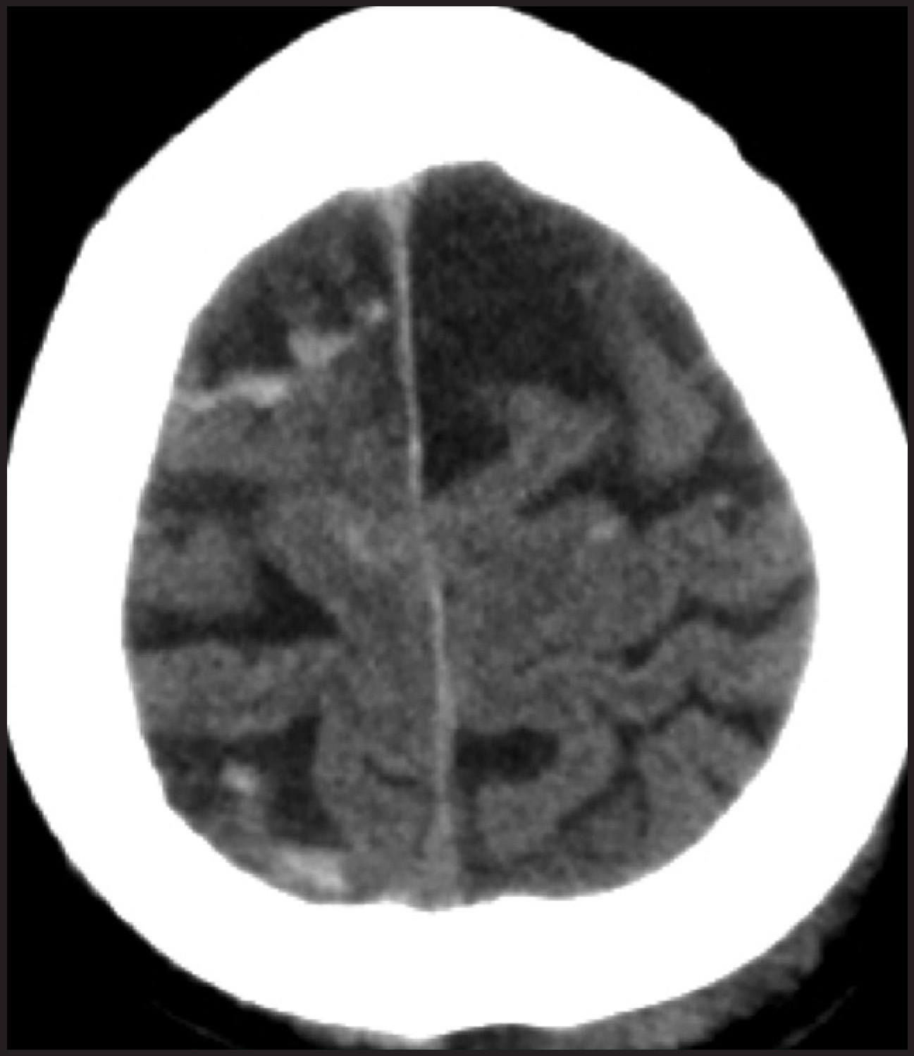 FIGURE 13.