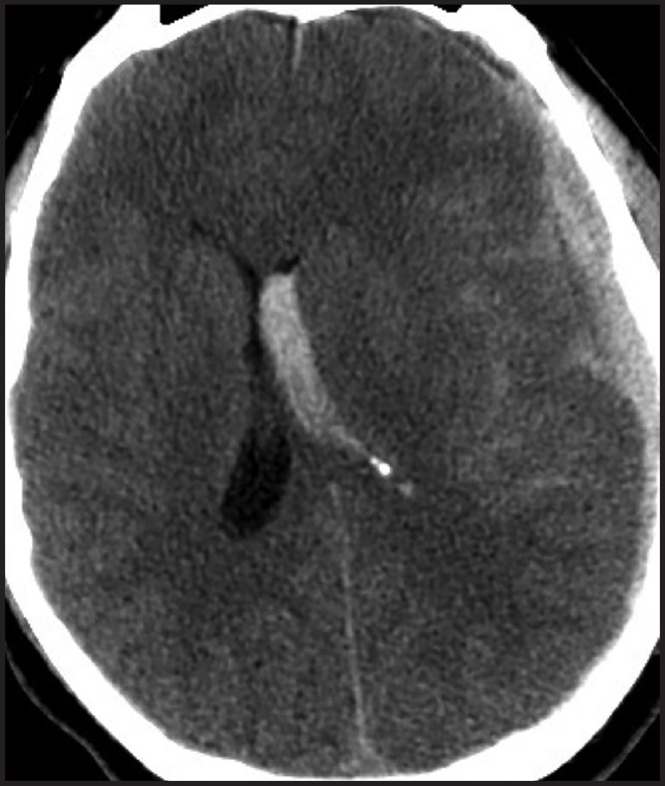 FIGURE 14.