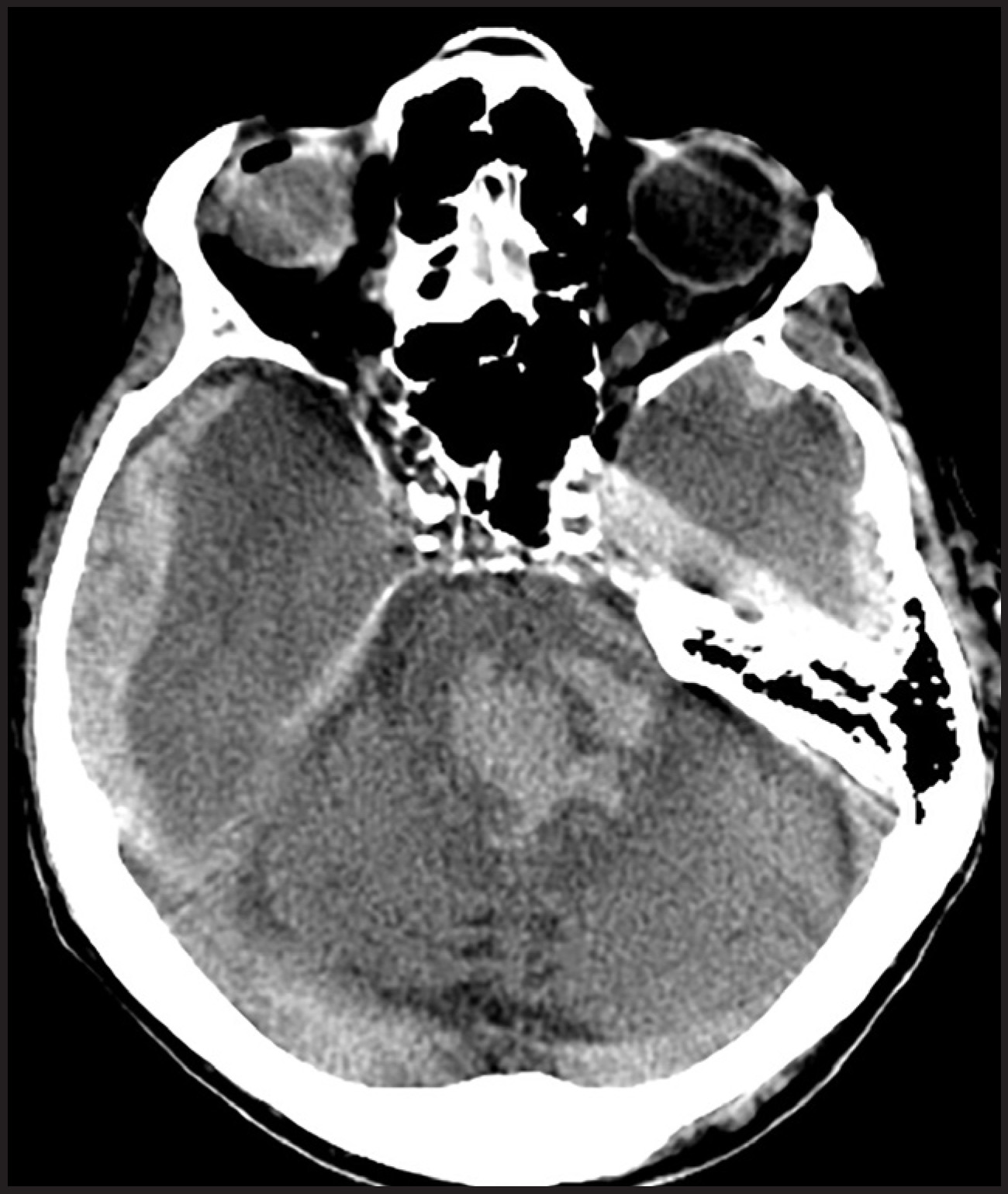 FIGURE 15.