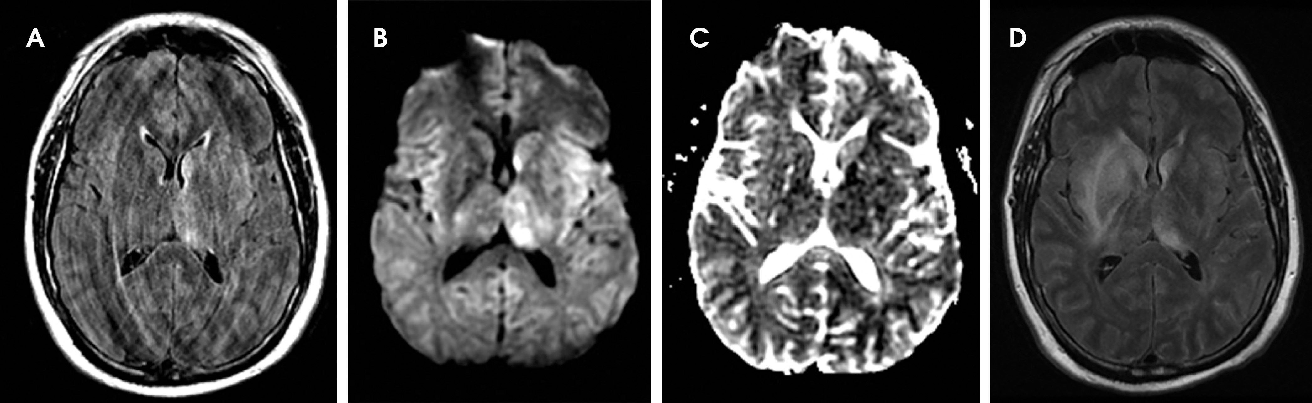 FIGURE 11.