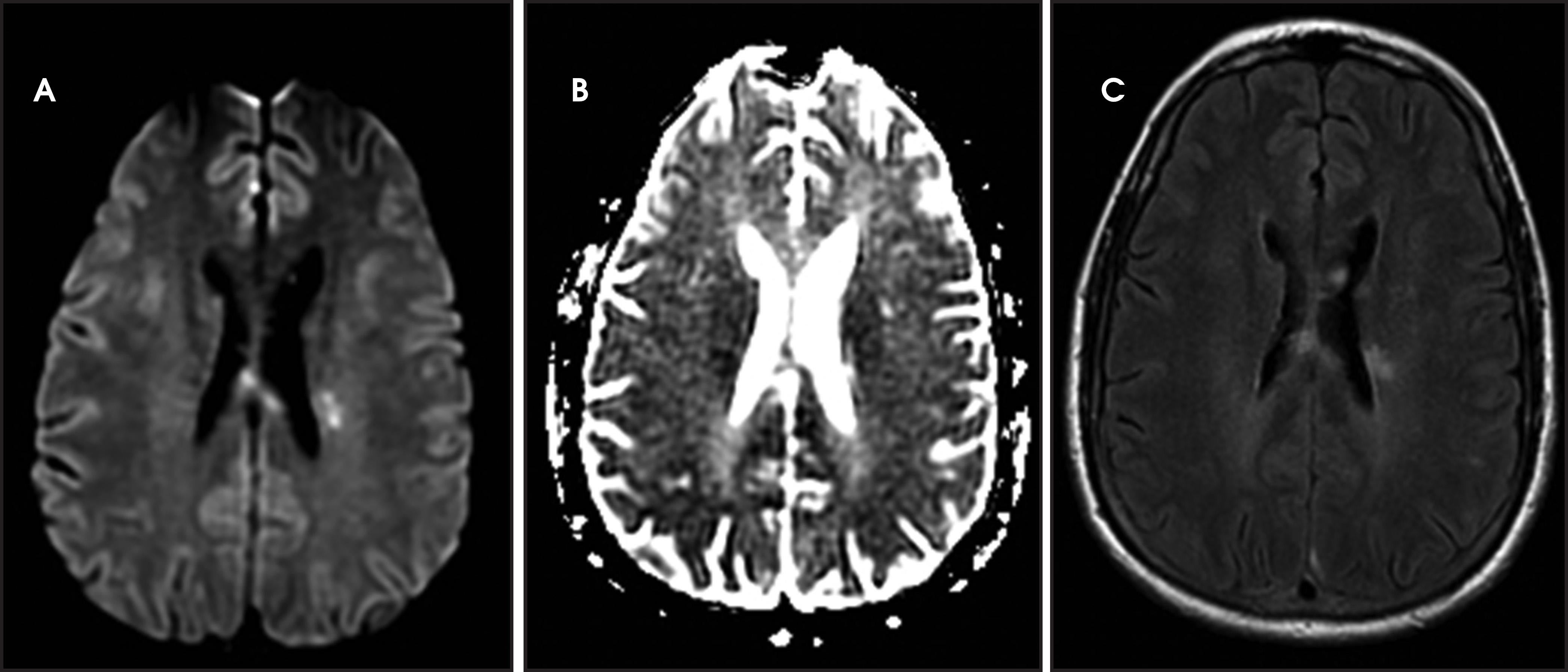 FIGURE 17.