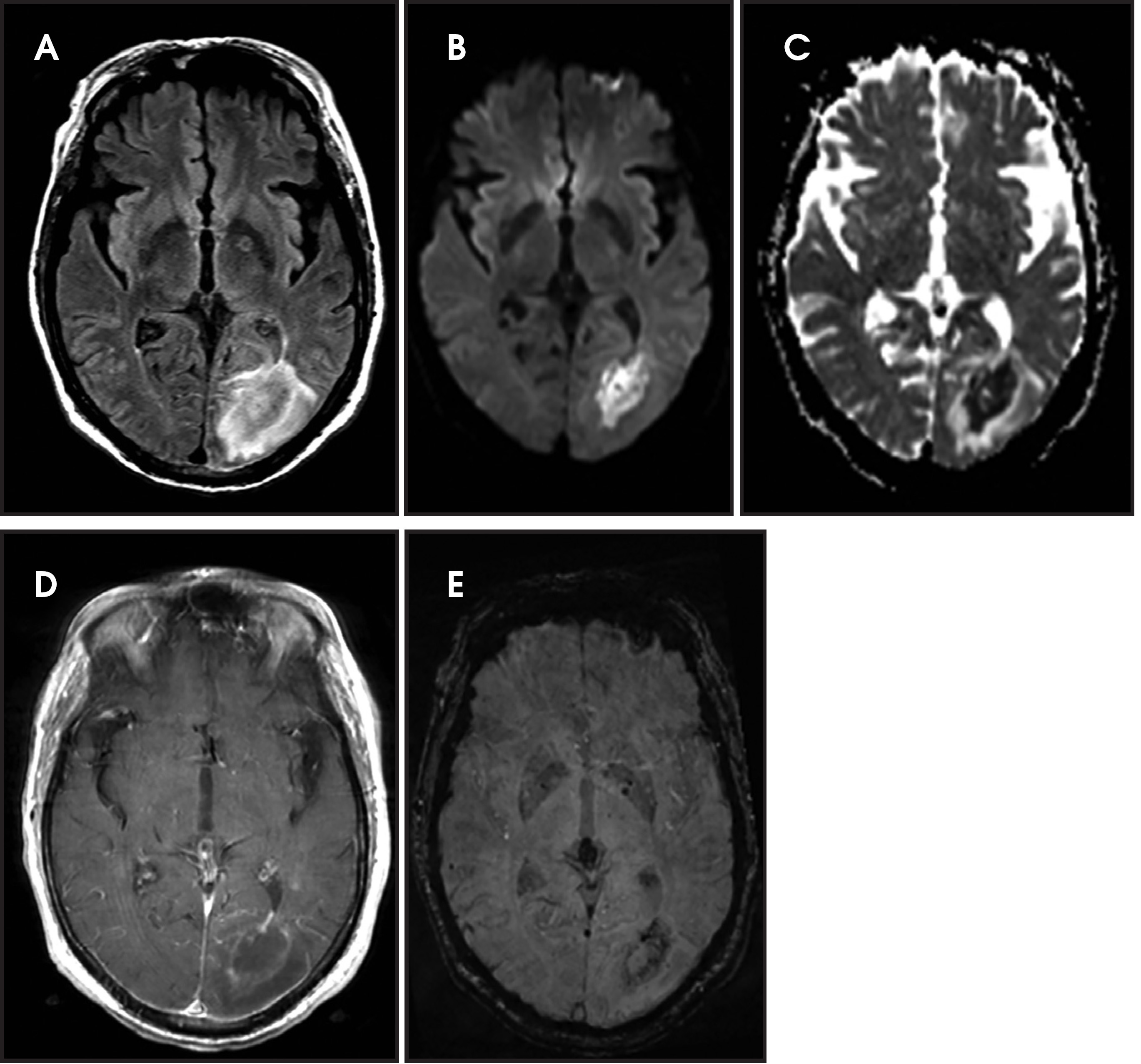 FIGURE 21.