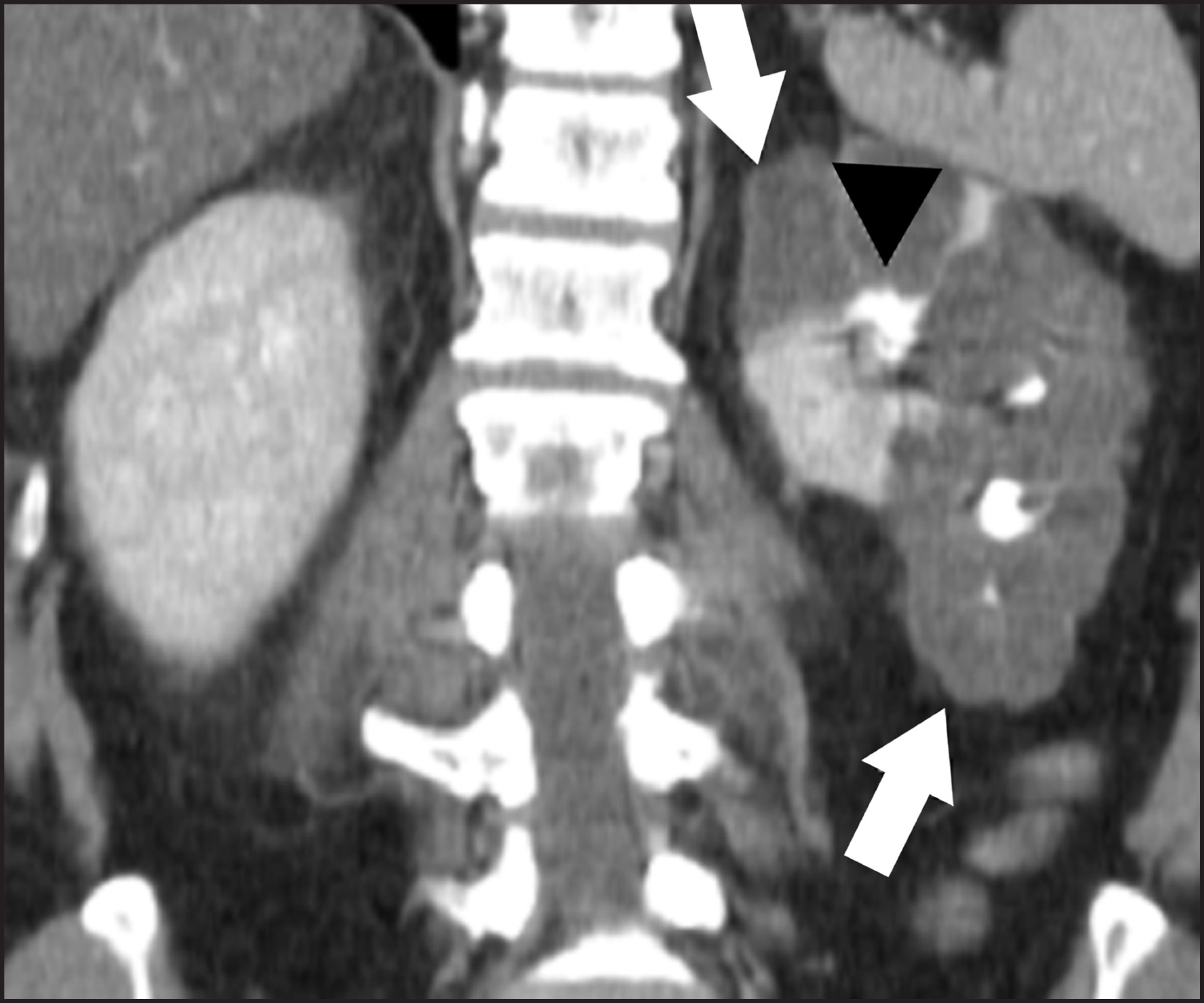 FIGURE 11.