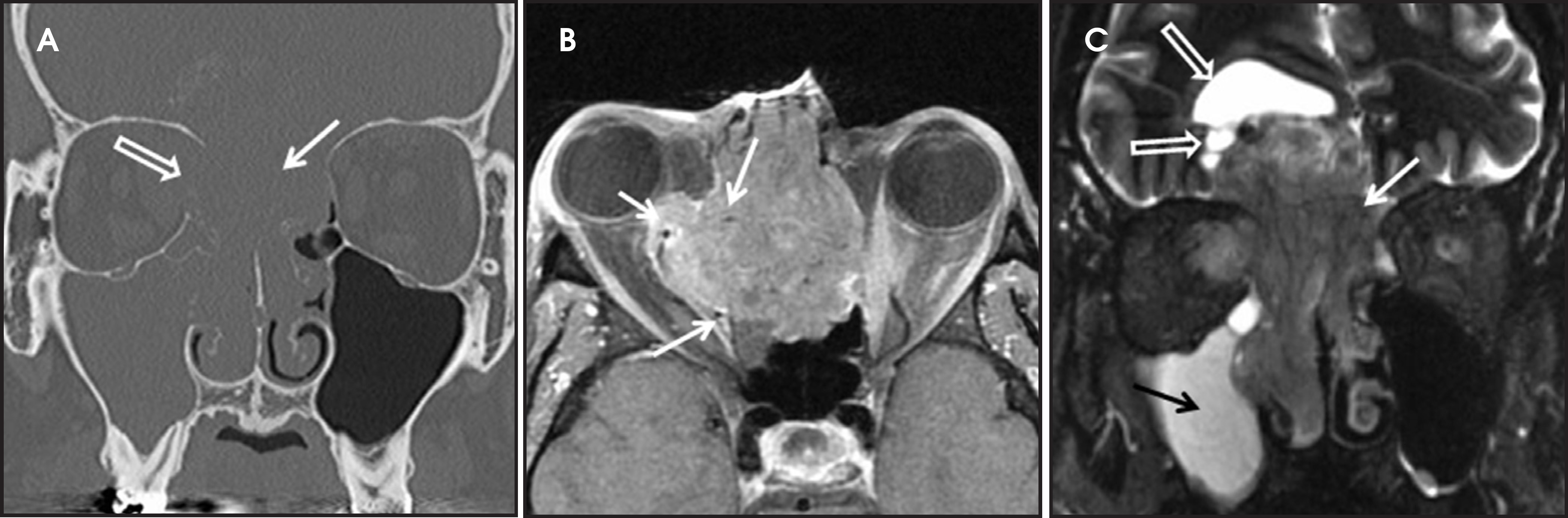 FIGURE 11.