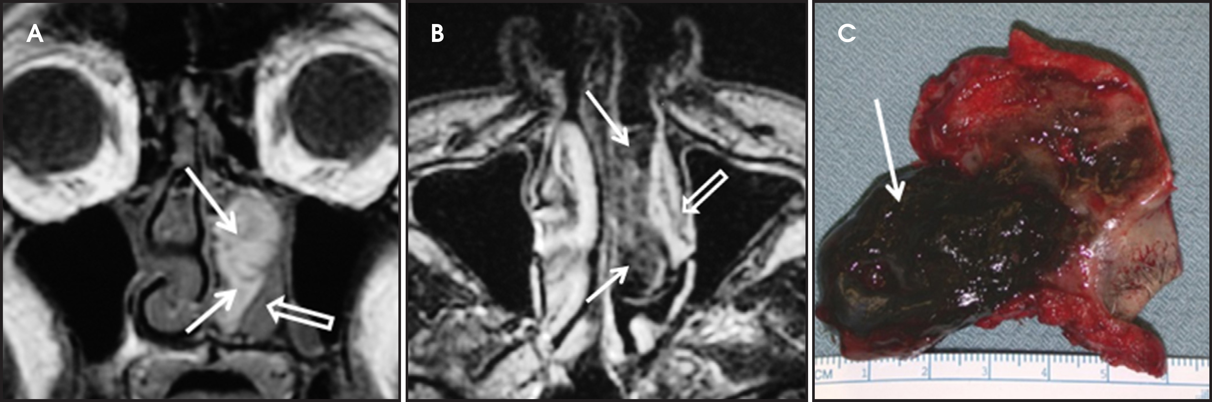 FIGURE 12.