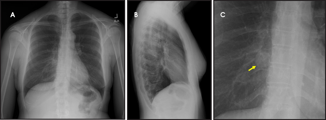 FIGURE 1