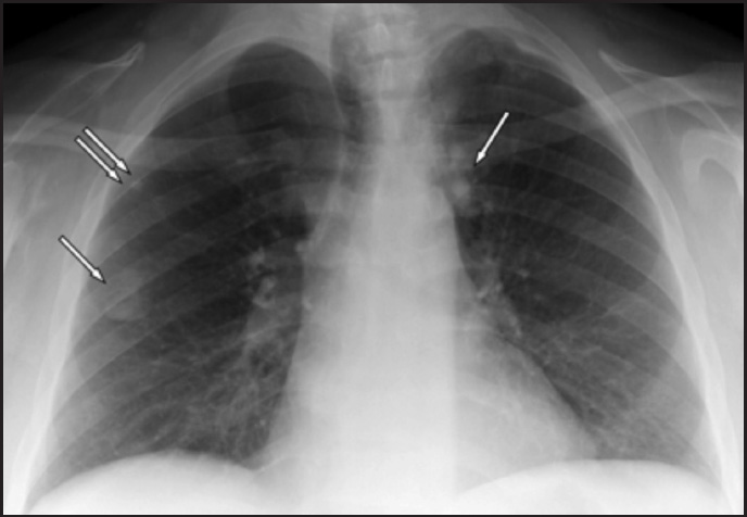 FIGURE 1