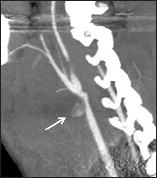 FIGURE 7.