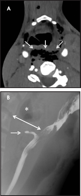 FIGURE 11.