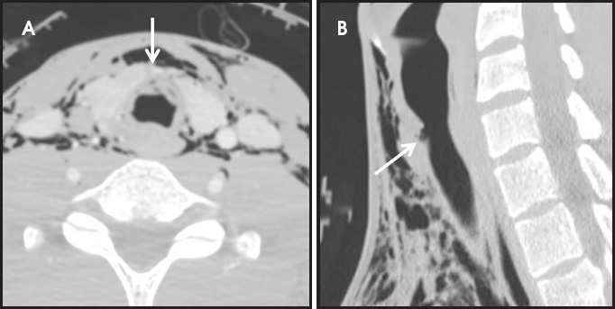 FIGURE 12.