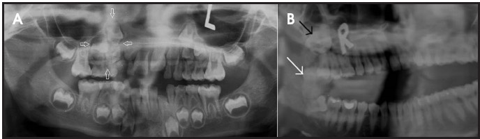 FIGURE 3.