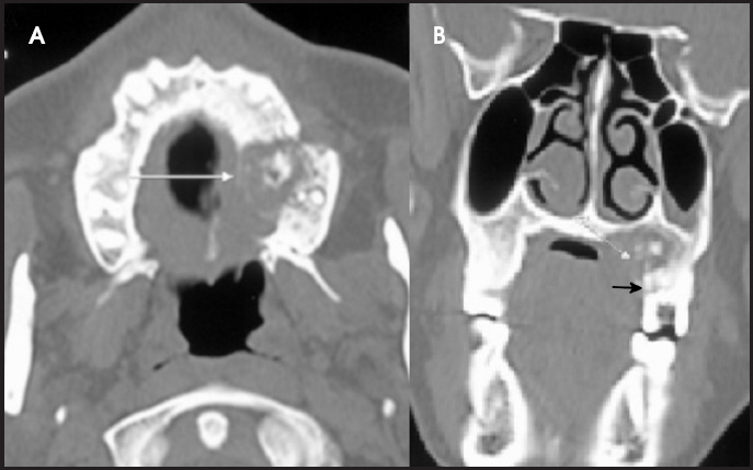 FIGURE 11.