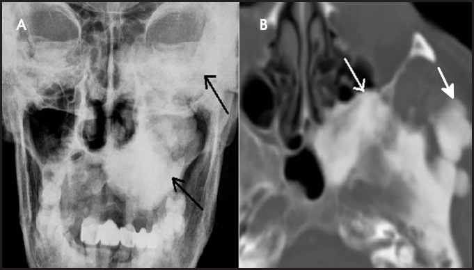 FIGURE 13.