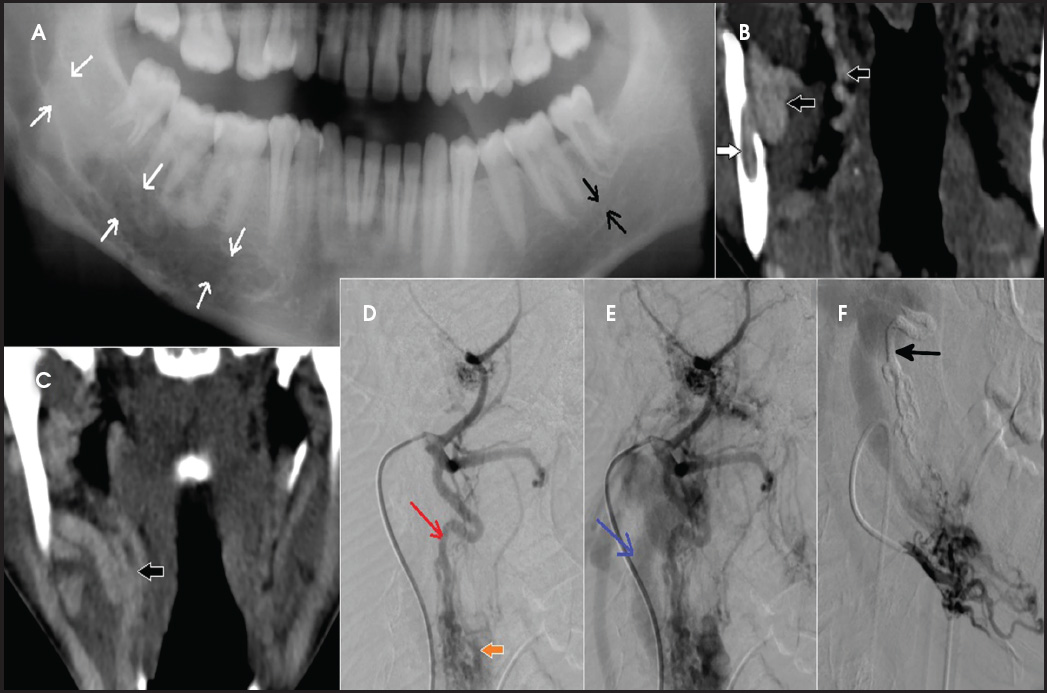 FIGURE 14.