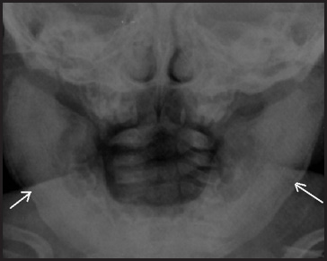 FIGURE 17.