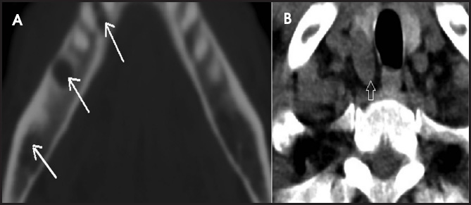 FIGURE 18.