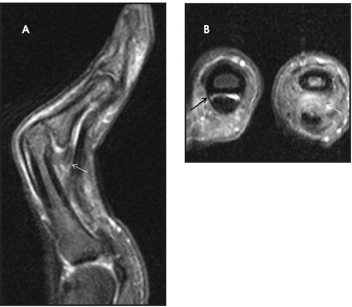 FIGURE 9.