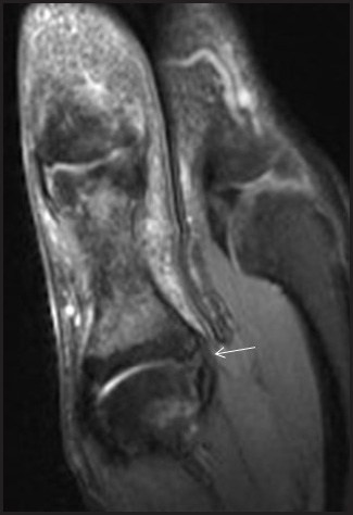 FIGURE 12.