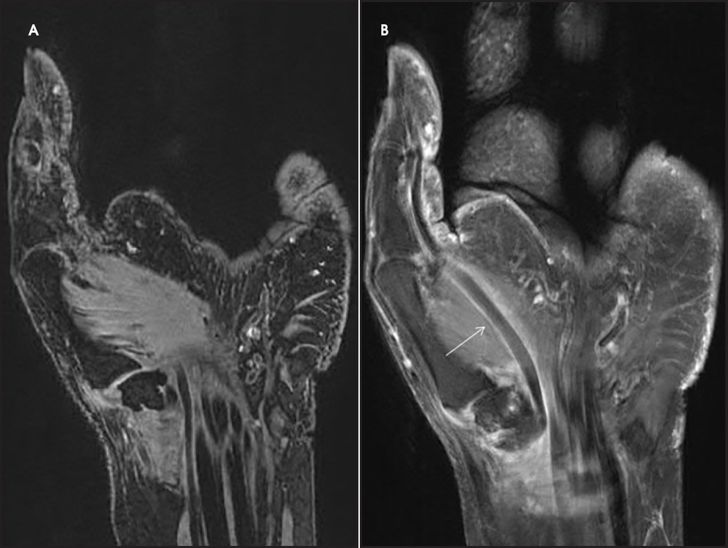 FIGURE 14.